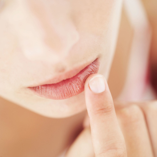 548a8f91d4886-rbk-chapped-lips-5149-4855-1458724410